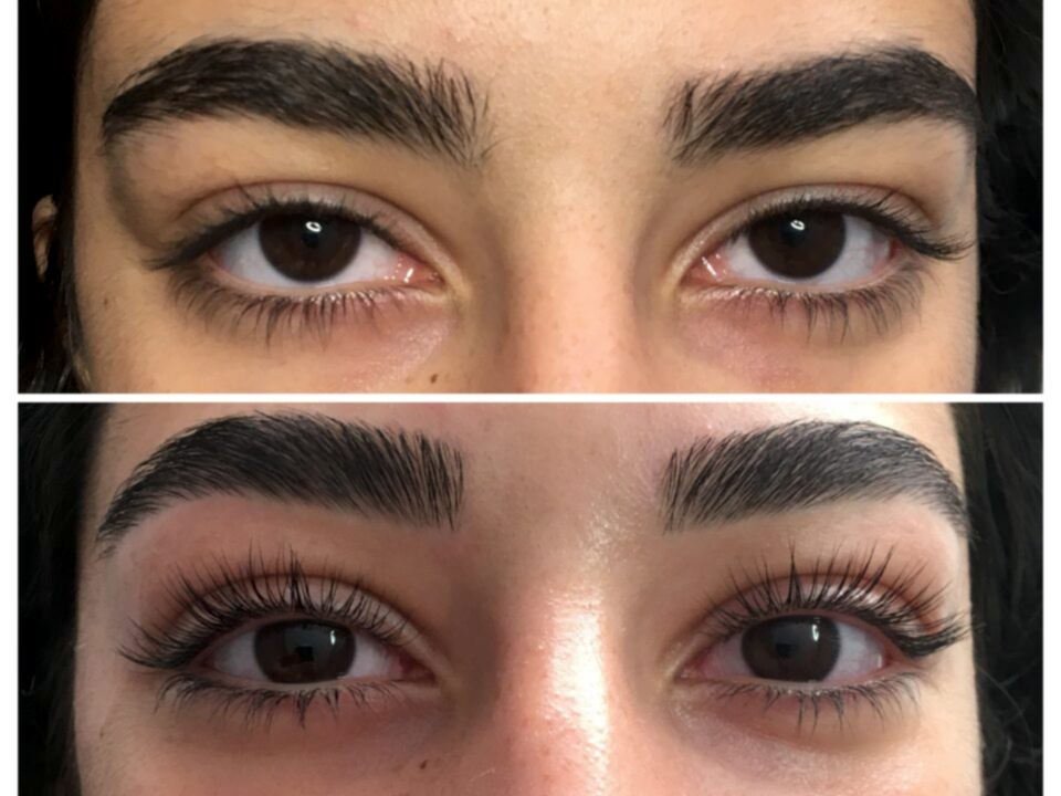 Kirpik Lifting Uygulaması