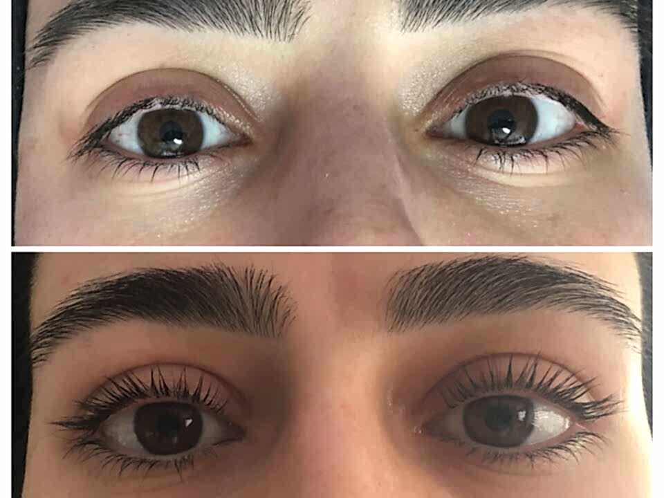 Kirpik Lifting Uygulamamız